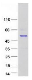 SDS-PAGE (RAD52-1565HFL).jpg